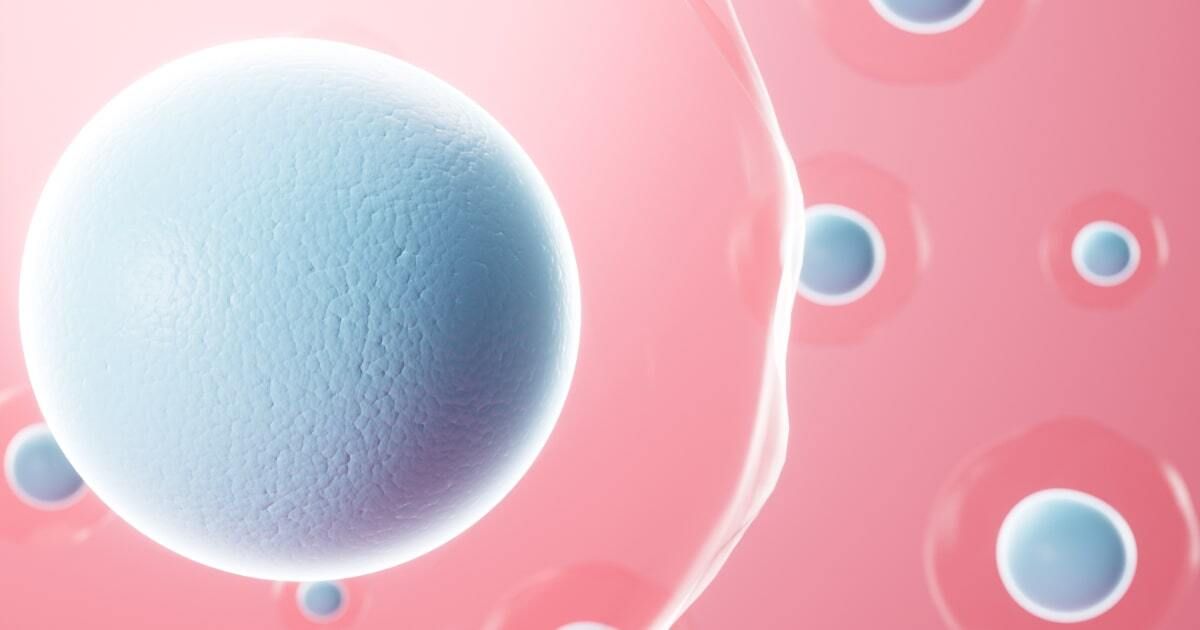 Congenital generalized lipodystrophy type 4