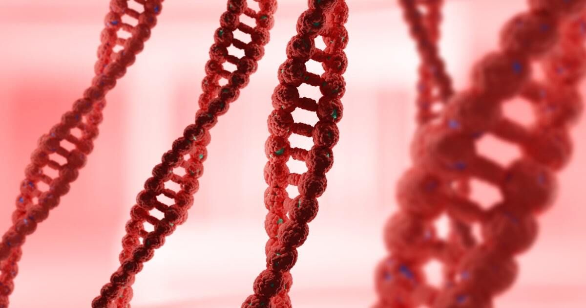 Immunodeficiency, X-linked, with hyper-IgM