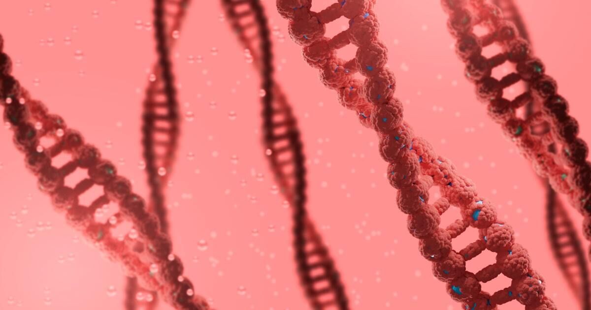 Glycogen storage disease IV, classic hepatic