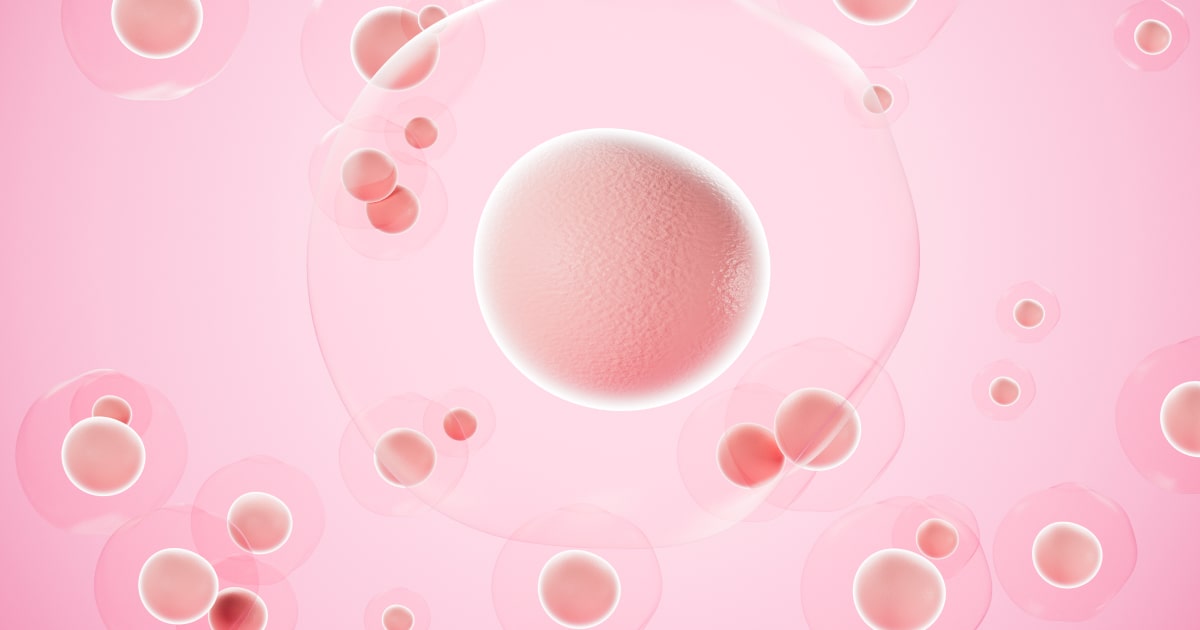 Developmental and epileptic encephalopathy, 32 Developmental and epileptic encephalopathy, 32