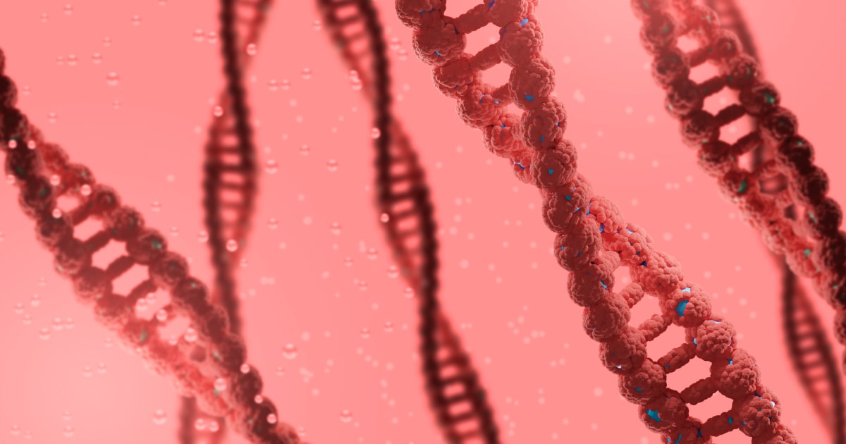Glycogen storage disease IV, classic hepatic