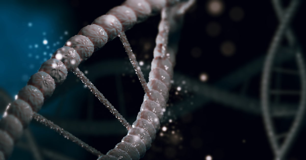 Isolated microphthalmia 6