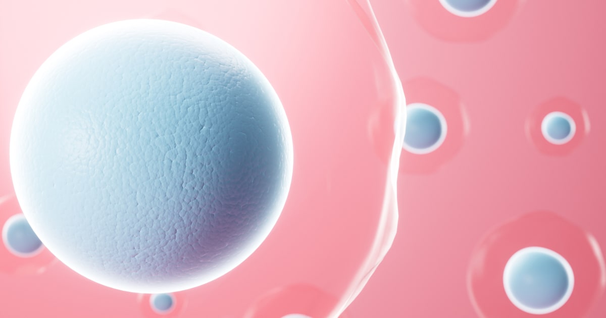 Laron syndrome with undetectable serum GH-binding protein