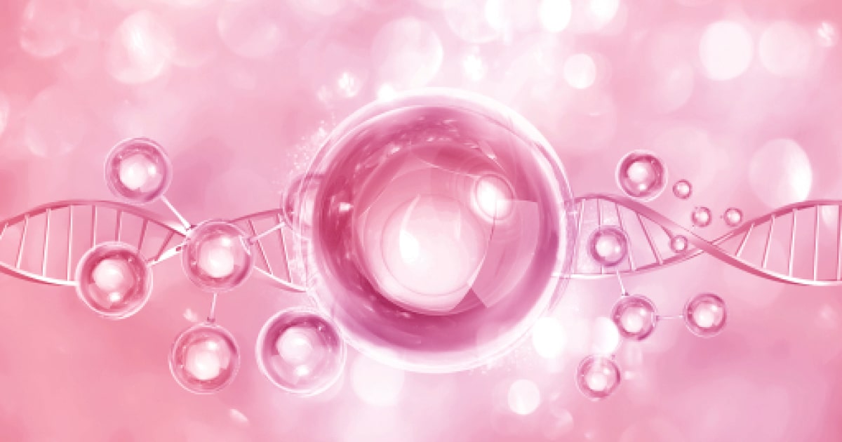 Severe combined immunodeficiency due to DNA-PKcs deficiency